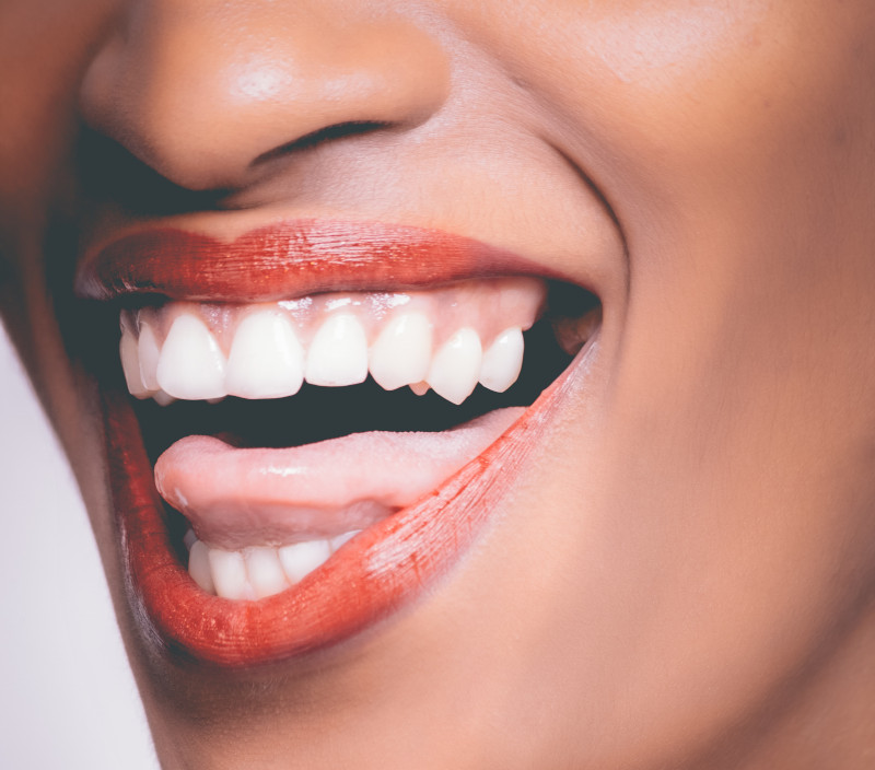 A close-up photo of a person with an open mouth smile that shows their teeth.